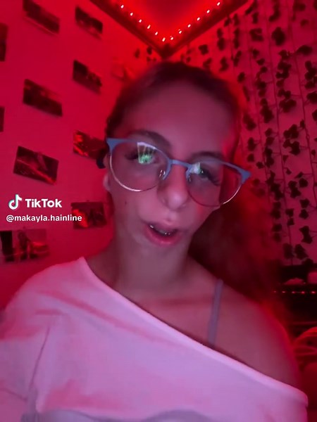 Understanding Treacher Collins Syndrome: A Personal Journey