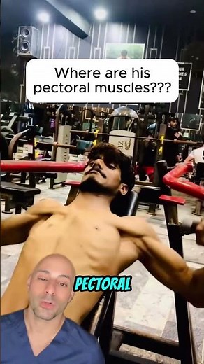 This Rare Disease Made His Pec Disappear...