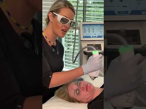 MOXI Laser Treatment Demo