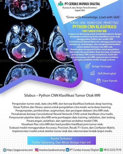 Kursus - Jasa - Source Code - Project Files Python – CNN Klasifikasi Tumor Otak MRI | Medical Image