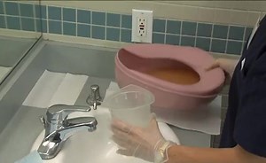 Measuring Urinary Output