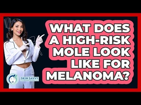 What Does A High-risk Mole Look Like For Melanoma? - Skin Savvy Dermatology