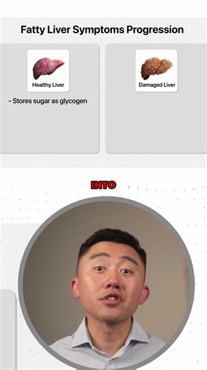 The connection between Fatigue and Fatty Liver