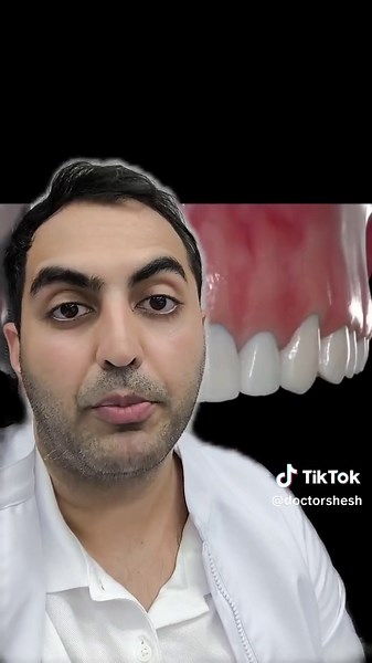 ปุ่มจัดฟันใสสำคัญอย่างไร รีบแจ้งคลินิกทันที