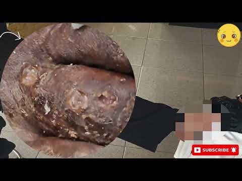 ⚡ Shocking Jigger Cluster – Dry Cracks Split Open to Expose Nests! #UD266