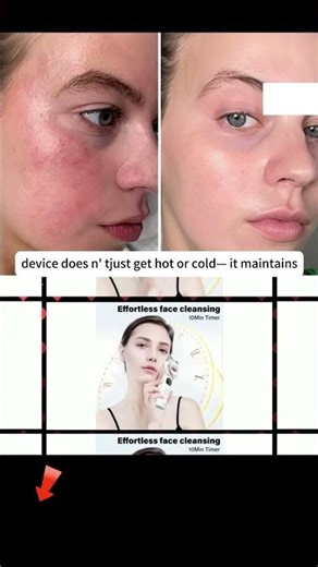 face lift Redefine Your Silhouette.