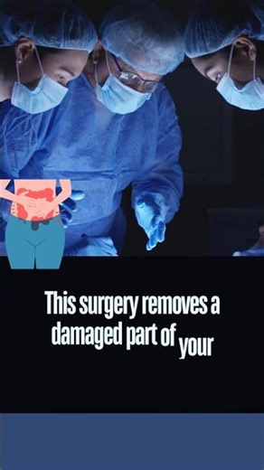 Bowel Resection: Facts You Need