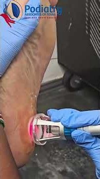 Laser Treatment 📹