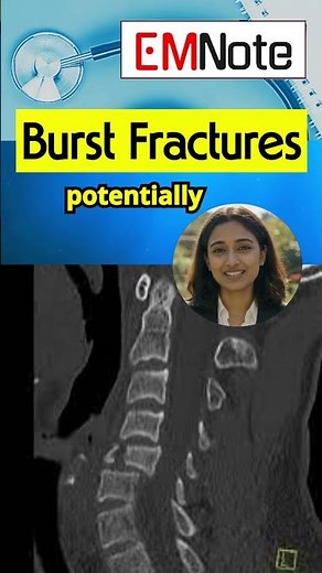 Compression, burst, and Chance fractures