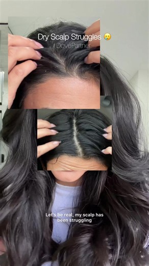 #DovePartner @Dove Beauty & Personal Care Say goodbye to dry scalp 🥲 If you deal with itchiness a dry scalp like me, it might be time to level up your scalp care. I’ve been using the Dove Derma Scalp Dandruff Relief system serum and my scalp feels so much more comfortable and my hair looks visibly healthier✨ What scalp struggle are you leaving behind this year? 👇 #DoveDermaScalp #DandruffRelief