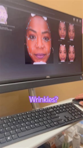 The @LightStim is a beast!#masteresthetician