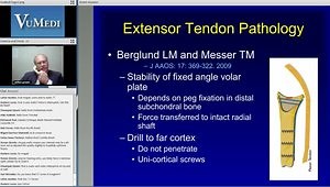 Distal Radius Fractures: Tips and Tricks