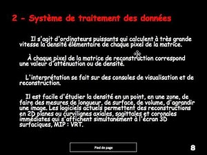 LE SCANNER