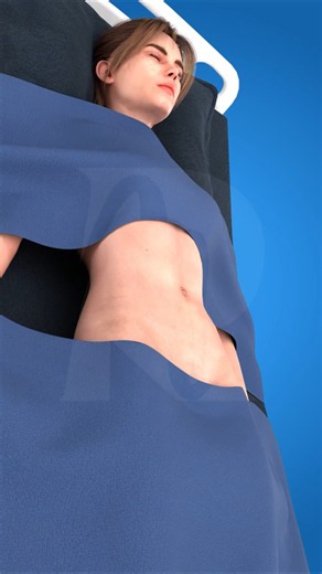 Tummy Tuck Surgery Explained – How Excess Skin is Removed & Belly Button Repositioned 🔥