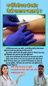 गर्भनिरोधक इंप्लांट कैसे लगाया जाता है ? Implantation process in female || #viral #implantation