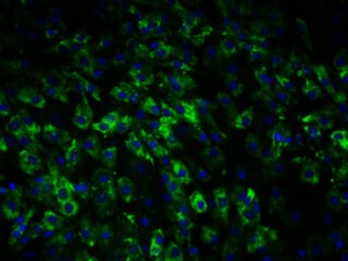 NHDF-Ad - Human Dermal Fibroblasts Adult | Lonza