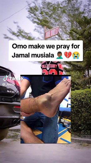 Jamal Musiala's Emotional Moment After Injury