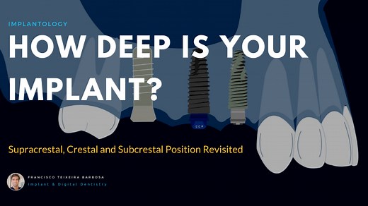 How Deep Is Your Implant? Supracrestal, Crestal, and Subcrestal Implant Position Revisited.