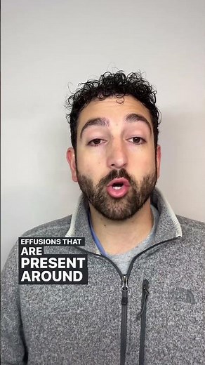 Right Atrial Systolic Collapse Explained