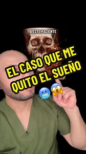 Tumor Facial Confundido Con Caries Dental