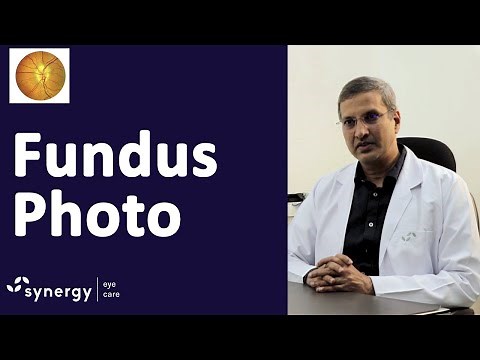 Fundus Photo – The Photo of the Retina