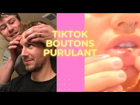 TIKTOK BOUTON PIMPLE POPPING 7