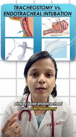 Invasive vs non invasive ventilator #ventilation #neet #Ards #medical