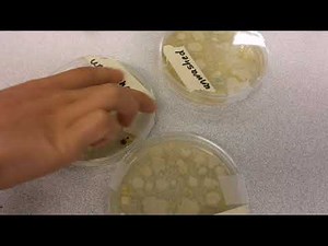 Growing bacteria in a petri dish STEM activity for kids!!