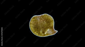 Acoela worm of Convolutidae family under a microscope, type Xenacoelomorpha. They have a symbiosis with algae. Red sea