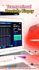566 reactions · 187 shares | Ever wondered how a transperineal prostate biopsy is done? This 3D animation shows a safer, more precise way to detect prostate cancer — with lower infection risk and better accurac #ProstateHealth #ProstateCancerAwareness #health #nonflower | medical 3d animation video | Facebook