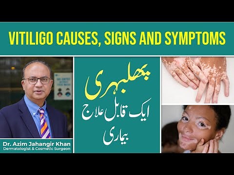 Vitiligo Explained: Symptoms, Causes, Types & Treatment Options | Dr. Azim Jahangir Khan