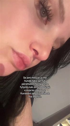 🫶🏻 #fyp #viral #shqip