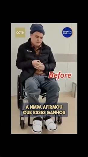 China aprova 1º BCI comercial do mundo: restaura mãos paralisadas! #Neurotech #BCI #Inovação #Saúde