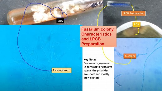 Fusarium species: General Characteristics, Pathogenesis, Clinical Findings