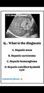 126K views · 533 reactions | What is the diagnosis #ultrasoundscan #ultrasound | Usg Imaging Study | Facebook