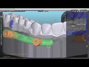 B4D Stackable Guide 15