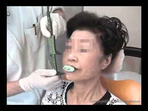 centric tray Technique