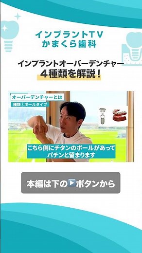 【インプラントオーバーデンチャー 】4種類を解説！