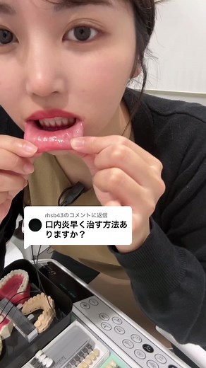 口内炎を早く直す方法とオルテクサーの効果