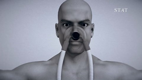 How do ventilators work?