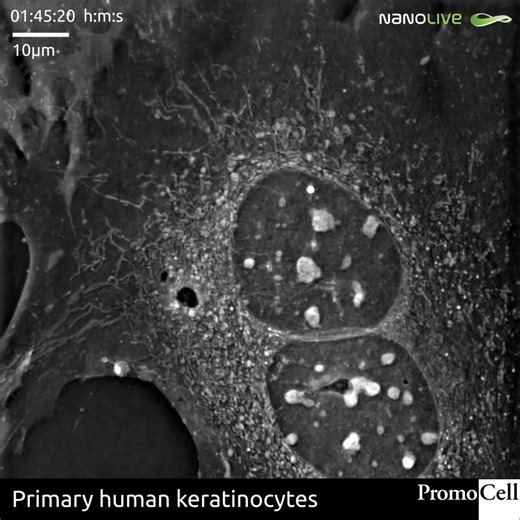 𝗛𝗶𝗴𝗵 𝗰𝗼𝗻𝘁𝗲𝗻𝘁 𝘀𝗰𝗿𝗲𝗲𝗻𝗶𝗻𝗴, 𝗹𝗶𝘃𝗲 & 𝗹𝗮𝗯𝗲𝗹-𝗳𝗿𝗲𝗲