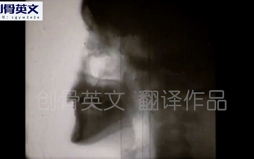 Salter-Harris骨折分型