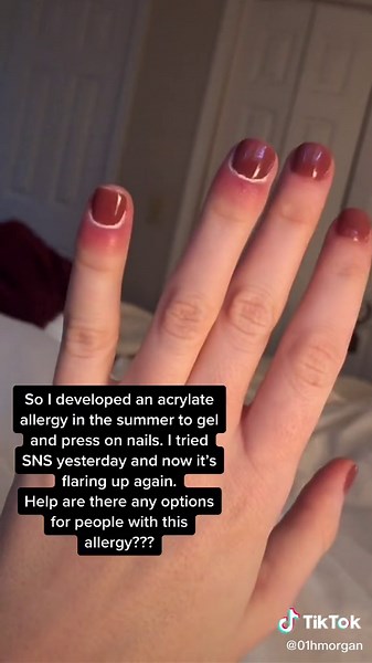 Dealing with Acrylate Allergy: Tips for Pretty Nails