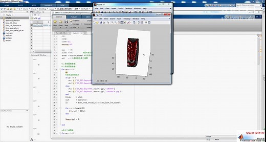 MATLAB代做-三维光流场三维医学图像重建