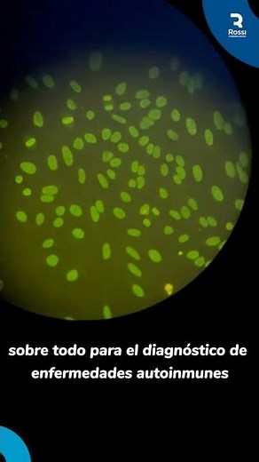 ¿Para que se utiliza la Inmunofluorecencia en los Laboratorios Clínicos?