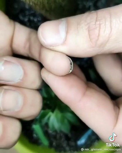 Microbes in the nails: microorganisms effects 2021