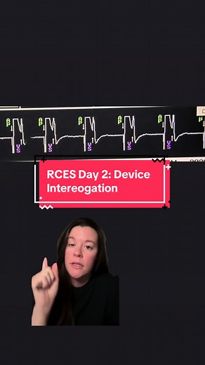 Understanding Pacemaker and ICD Device Interrogation