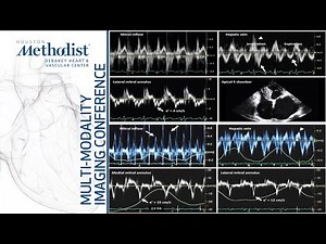 Pericardial Diseases: Echo/CT/CMR-Complementary or Redundant?(M Malahfji MD, F Nabi MD) June 7, 2022