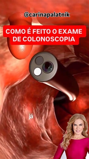 SINAIS QUE SEU INTESTINO PRECISA DE ATENÇÃO ! COLONOSCOPIA SEGURA !CARINA PALATNIK
