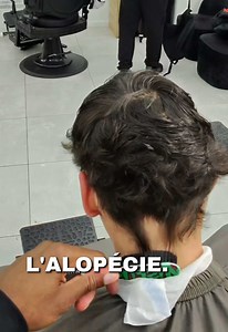 Comment réaliser un taper sur un client avec alopécie